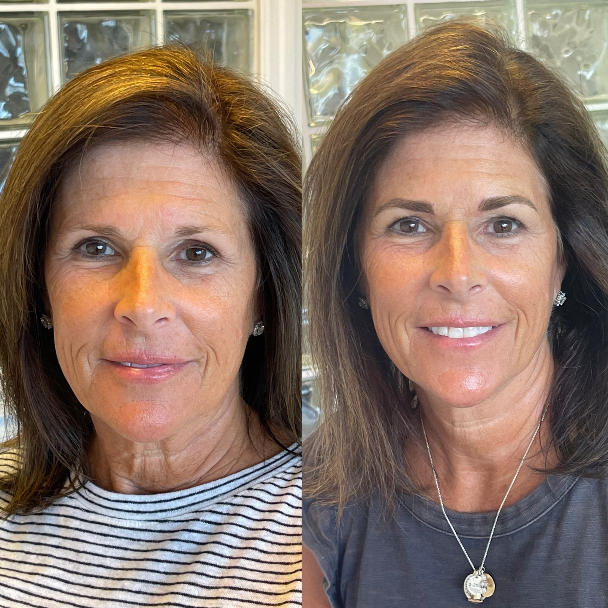 Permanent makeup before and after - full face transformation