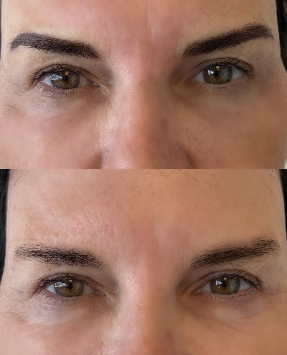 Permanent makeup before and after - eyebrows close-up