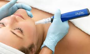 SkinPen Microneedling